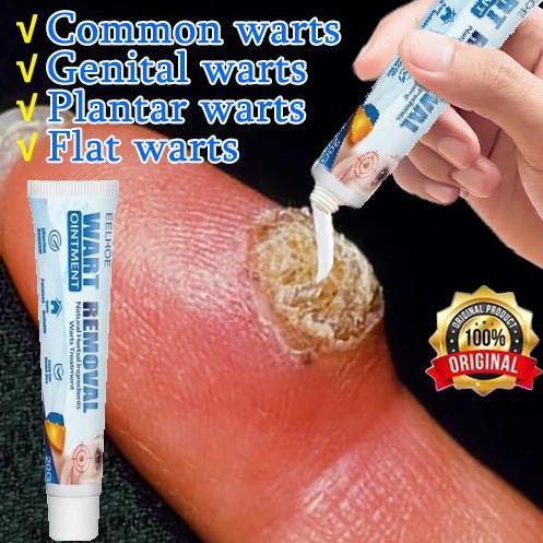 Penghilang kutil Obat kutil dan tahi lalat Penghilang tahi lalat di wajah Obat kutil kelamin