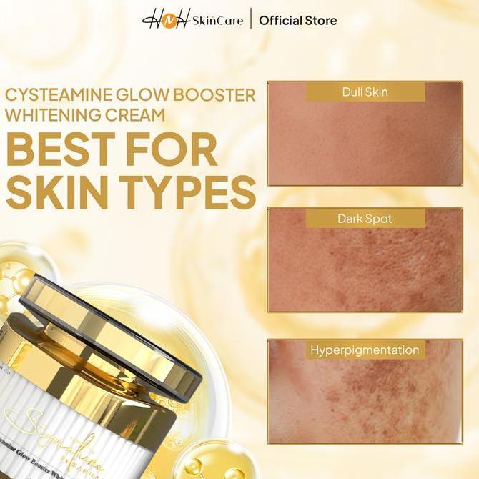 Zexus- Signature By Kamila - Cysteamine Glow Booster Whitening Cream - Cysteamine Cream Untuk Flek H