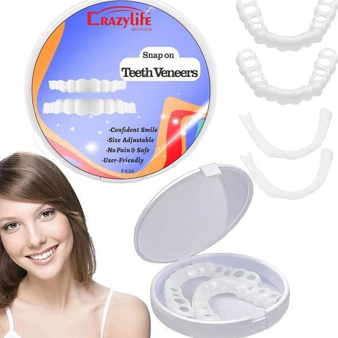 Remarkable Teeth Veneers Tooth Cover Set Dentures Dental Veneers Snap Original