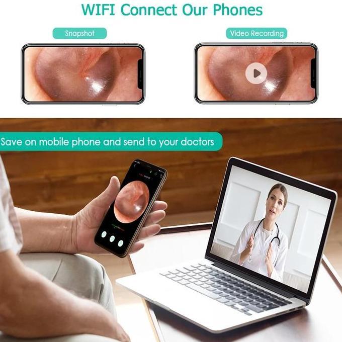 Wifi Kamera Endoscope HD 720P - Endoscope Mini Kamera Wifi [terbaik]