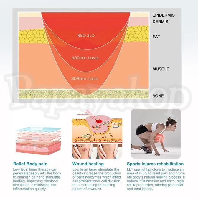 Sale 36 Laser Terapi Nyeri Sendi, Syaraf & Otot - Laser Pain Box Relief Dr