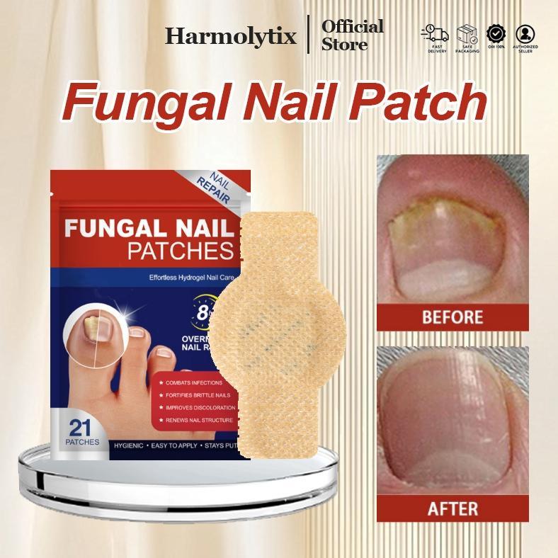 Obat Jamur Kuku Obat Cantengan Obat Kuku Rusak Pembersih Kuku Kaki Hitam Fungal Nail Treatment Funga