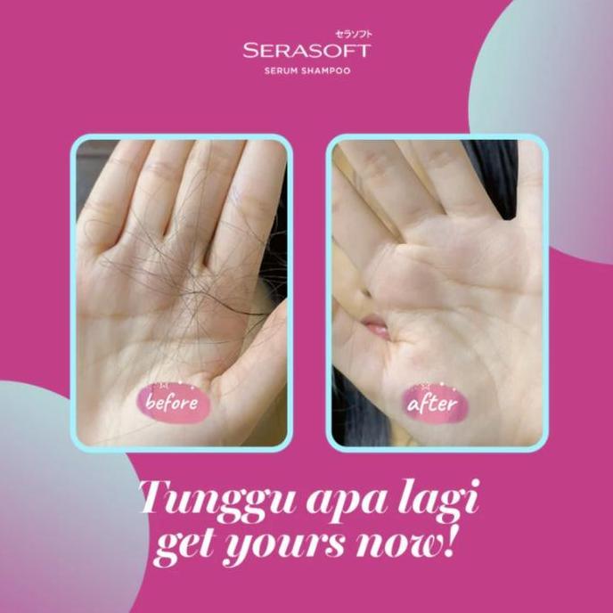 Styling- Serasoft Shampoo 340Ml / Shampo / Sampo Hair Perawatan Rambut Varian Hairfall / Dandruff / 