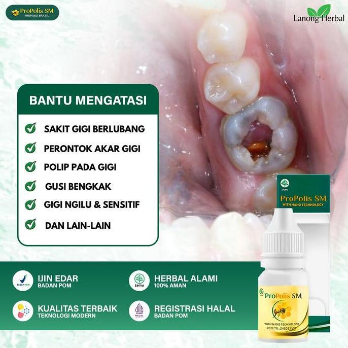 Obat Pencabut Gigi Berlubang Perontok Gigi Sampai Akar Penghancur Gigi Berlubang Cepat Sembuh