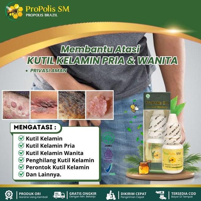 Feminin- Kutil Kelamin Hpv, Perontok Kutil Kelamin Jengger Ayam Hpv, Penghilang Kutil Kelamin, Mengh