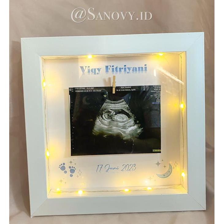 2020012 Pigura / frame 3d USG Baby Photo Frame