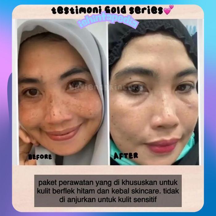 GF21 [Official]Daviena Skincare|GOLD SERIES|PEMUTIH WAJAH BPOM DAVIENA SKINCARE|DAVINA  SKINCARE Ter