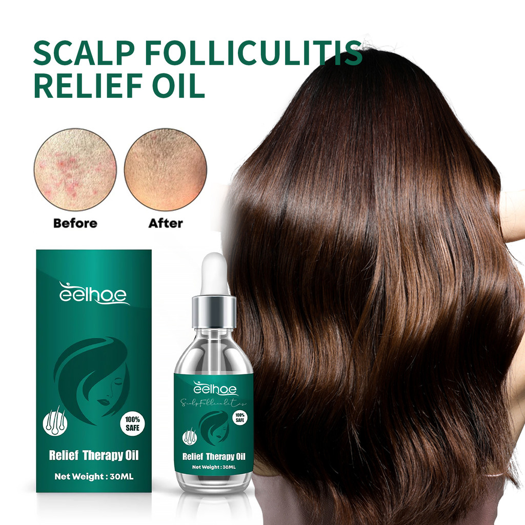 EELHOE Scalp Folliculitis Relief Oil 30ml Serum Ketombe dan Psiorasis Kulit Kepala Dermatitis seboro