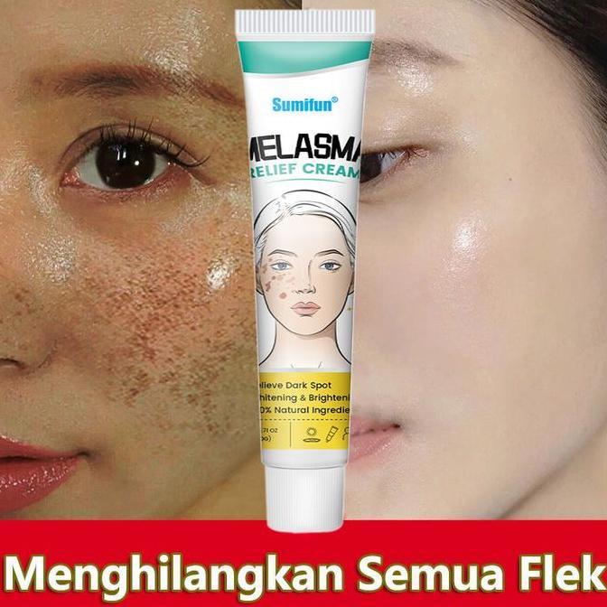 Whitening Freckle Cream BPOM Krim Flek, Melasma & Glowing 2gr