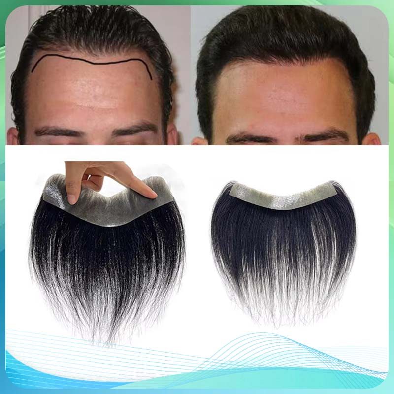 Toupee Human Hair Hair Line Front Skin Toupee Hair Line Wig Laki Laki Rambut Palsu