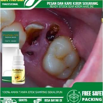 Obat Perontok Akar Gigi Berlubang, Penghilang Sisa Gigi Berlubang, Gigi  Kuning, Perontok Gigi Sampa
