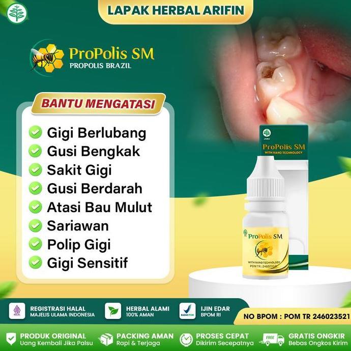 Obat Penghancur Gigi Berlubang, Obat Sakit Gigi Berlubang, Propolis SM