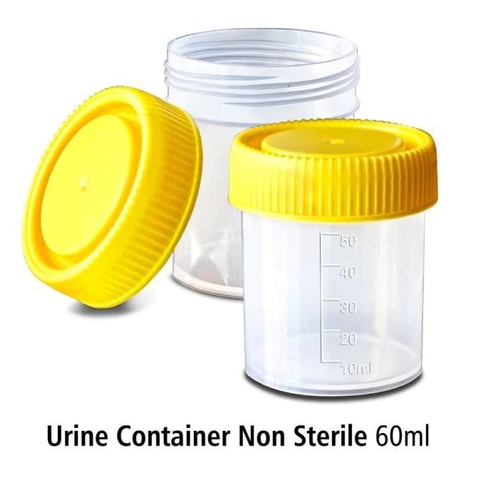 Pot Urin Non Steril 60ml Sample Container Pot Dahak Non Steril