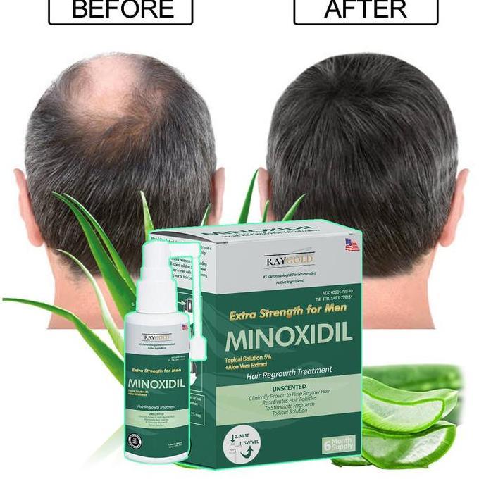 MINOXIDIL 5% penumbuh rambut & brewok with Aloe Vera for MEN made in USA - RAYGOLD - MINOX MINOKSIDI
