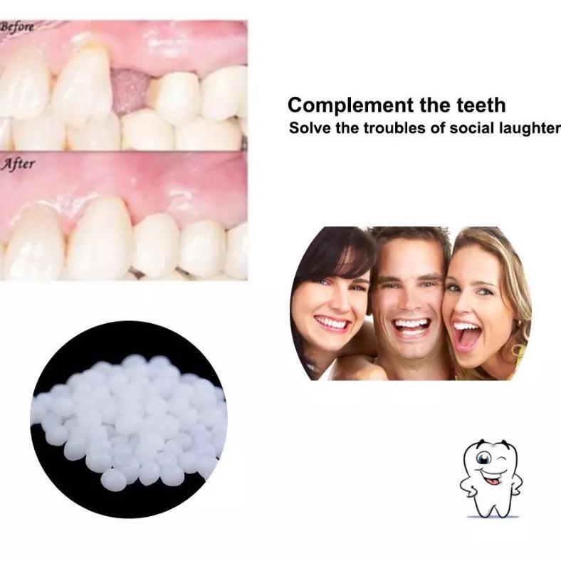 New Temptooth Diy Temporary Tooth Repair Kit Denture Adhesive Teeth Lem Gigi Palsu Tambal Sementara 