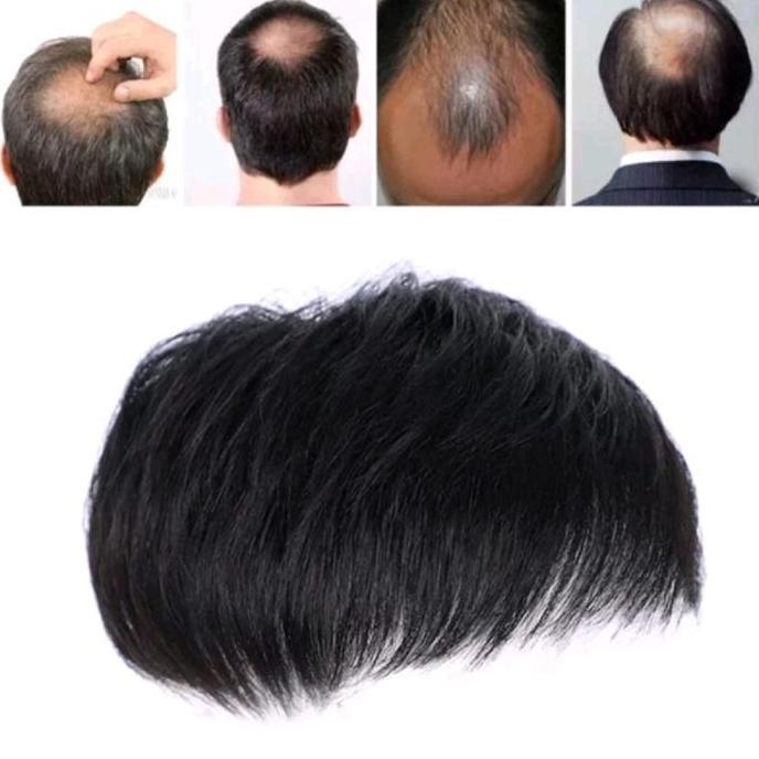 Rambut Palsu Penutup Botak / TOUPEE / Penutup Botak Pria