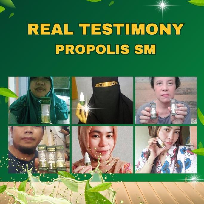 Healtiwi- Propolis Sm Salep Untuk Panu Hapur Kurap / Penghilang Panu Gatal Di Wajah Tangan Kaki Hita