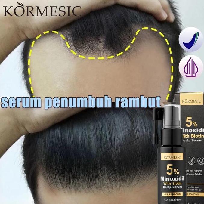 BARACSINGLETHONES - MINOXIDIL PENUMBUH RAMBUT BOTAK SERUM PENUMBUH RAMBUT OBAT PENUMBUH RAMBUT 30ML 