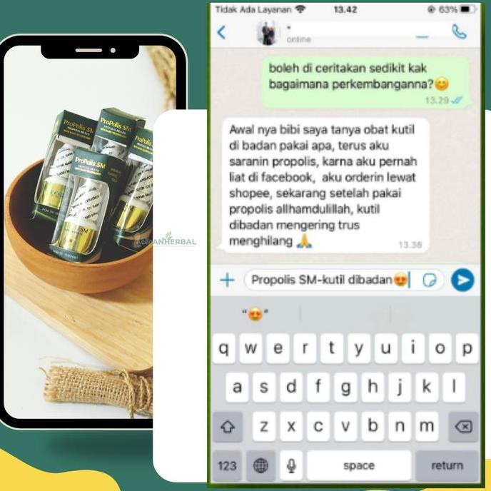 Sale Propolis Sm - Menghilangkan Kutil Dan Papiloma, Perawatan Kutil Dan Papiloma