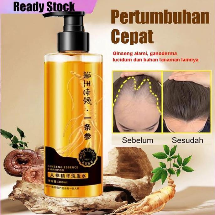 Haircare- Shampoo Penumbuh Rambut Cepat Ginger Shampoo 300Ml Shampoo Penumbuh Rambut Shampoo Anti Ro