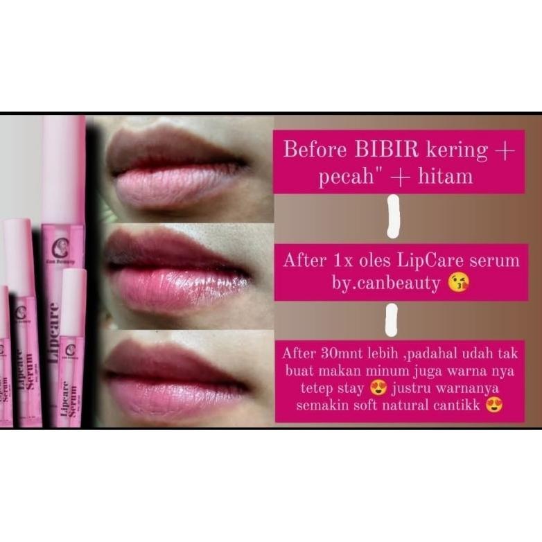 LIPCARE SERUM BY CAN BEAUTY/Lip Serum Can Beauty