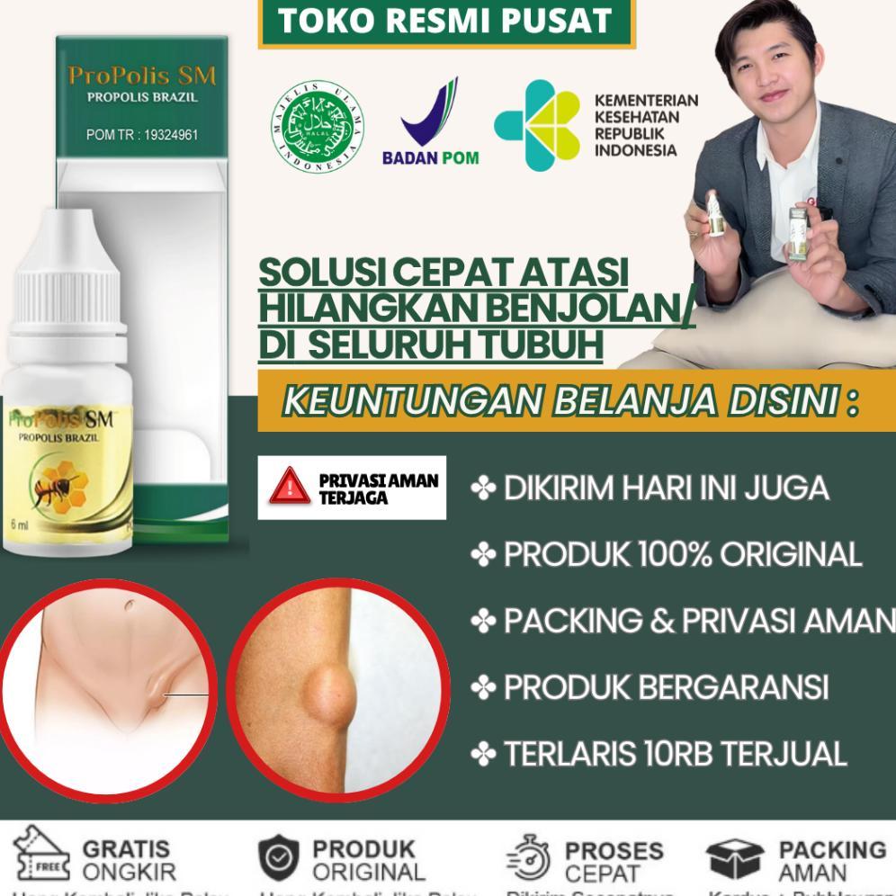 Obat Benjolan Selangkangan, Obat Penghancur Benjolan di Selangkangan, Obat Hilangkan Benjolan, Obat 