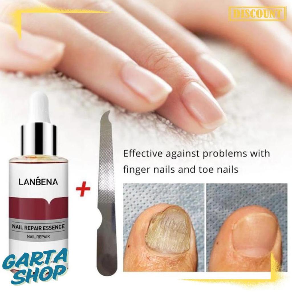 Cod Lanbena Nail Repair Essence Serum Perawatan Jamur Kuku Lanbena Nail