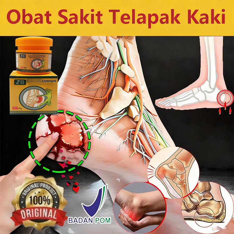obat sakit tumit plantar fasciitis terapi obat sakit telapak kaki pereda nyeri tumit terapi kaki sal