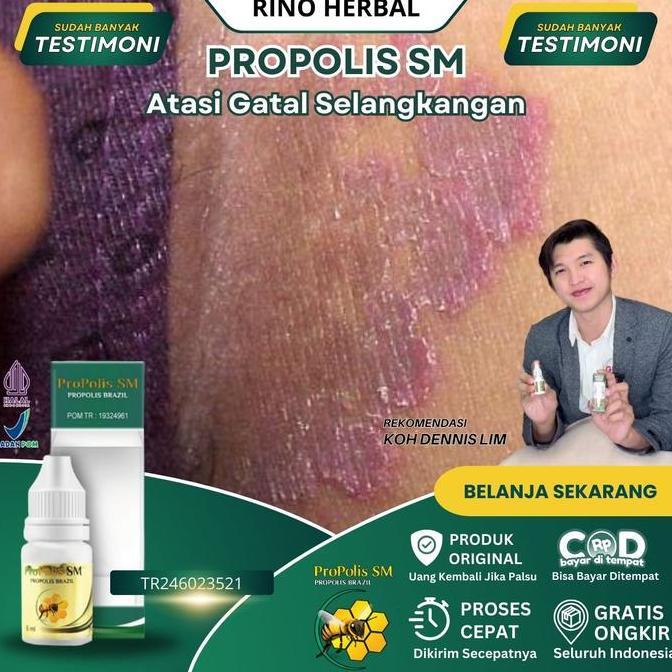 Selangkangan Hitam Dan Gatal, Selangkangan Lecet, Jamur Selangkangan, Selangkangan Hitam, Gatal Sela