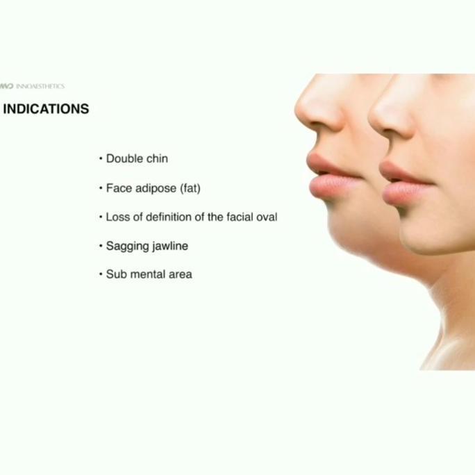 Gaskuyy- Face Nade Ecer Slimming Wajah Terdaftar Bpom