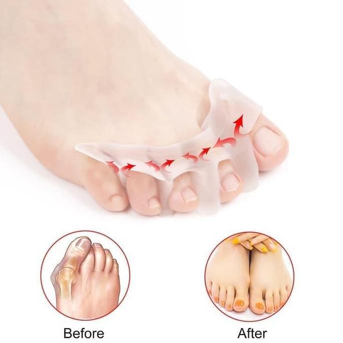 Pemisah Jari Kaki Silikon Gel Toe Separator Jari Jempol Silicon Bunion [terbaik]