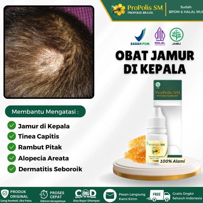 Propolis SM - Salep Oles Untuk Jamur di Kulit Kepala, Tinea Capitis, Dermatitis Seboroik, Rambut Pit