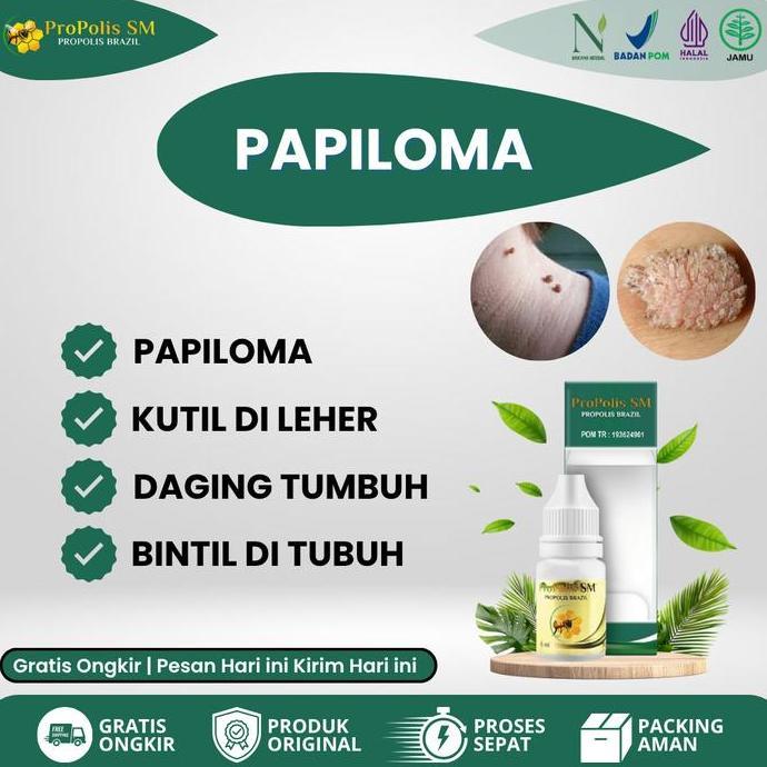 Propolis Sm Obat Perontok Penghilang Kutil Papiloma, Daging Tumbuh, Skin Tag, Punggung Berjerawat, K