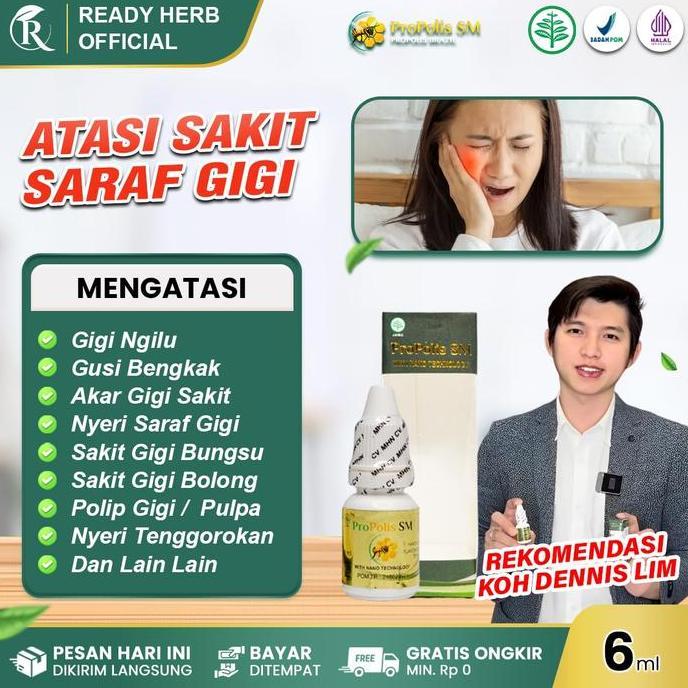 PROPOLIS SM Untuk Sakit Saraf Gigi, Perontok Akar Gigi Berlubang, Sakit Gigi Bungsu, Gigi Ngilu, Pol