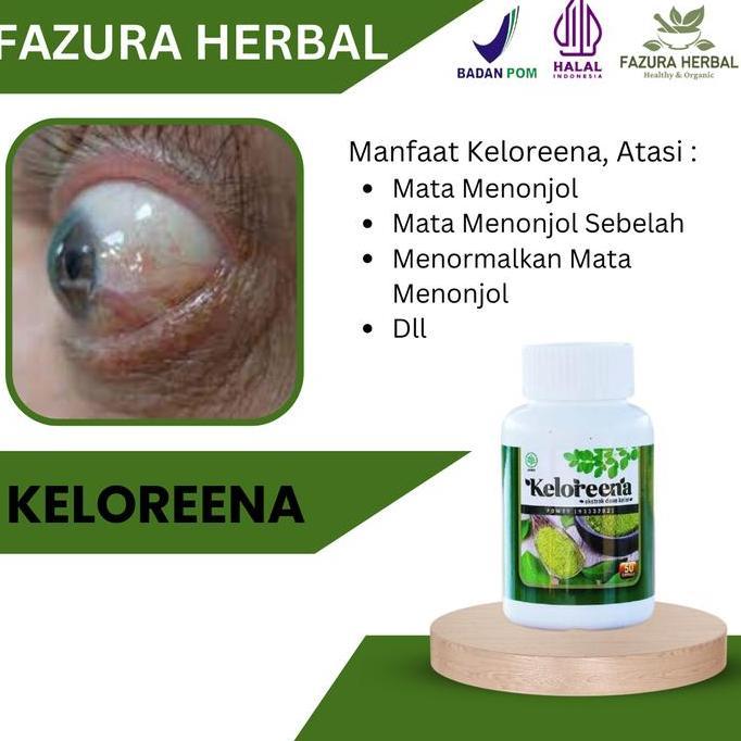 Feminin- Keloreena - Suplemen Atasi Mata Menonjol Menormalkan Mata Menonjol Akibat Hipertiroid Atasi