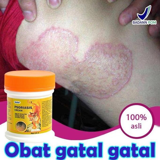 Bodies- 100% Original Obat Gatal Selangkangan Obat Panu Salep Gatal Obat Kurap 20G Obat Gatel Obat E