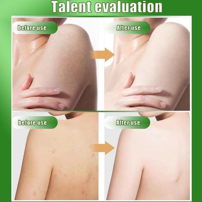 Promo Yzkmskin Body Scrub Lulur Pemutih Badan 250G Sabun Scrub Menghilangkan Sel Mati & Kulit Hitam 