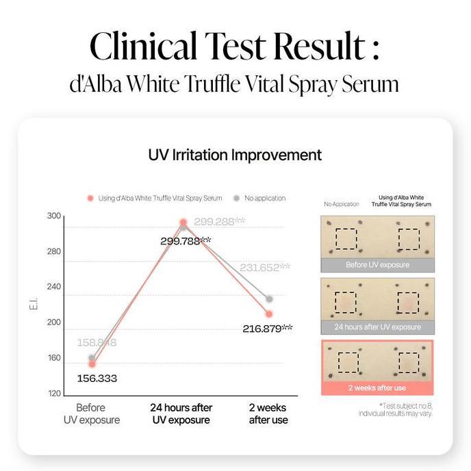 Iyaakirim- [K-Beauty Lux Campaign Special] D'Alba White Truffle Vital Spray Serum 100Ml