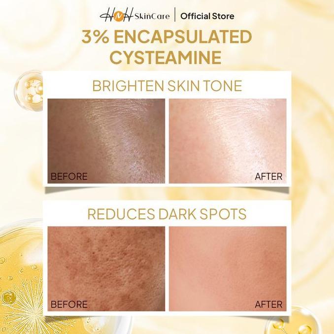 Iyaakirim- Signature By Kamila - Cysteamine Glow Booster Whitening Cream - Cysteamine Cream Untuk Fl