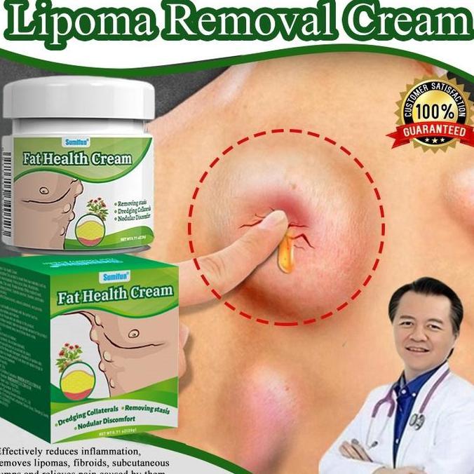 Lipoma Cream Obat Benjolan Obat Lipoma 20G Salep Benjolan Obat Benjolan Lipoma Obat Benjolan Payudar