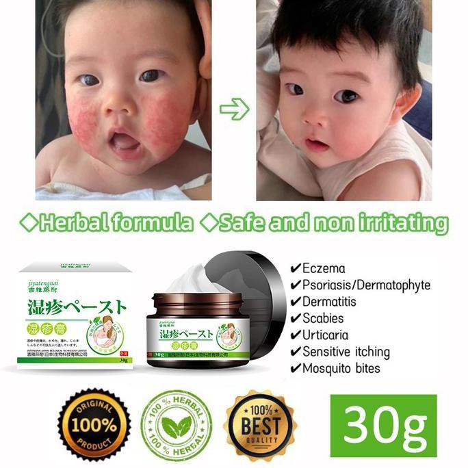 salep gatal paling ampuh salep eksim salep kadas kurap gatal ampuh salap gatal kulit yang ampuh