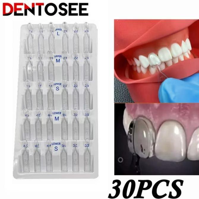 NEW PROMO 30PCS Veneer Gigi Dental Cetakan Veneer Gigi Alat Pemutih Gigi Veneer Original