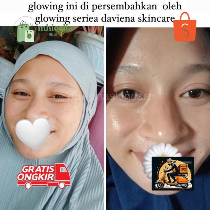 KT78 [Official] Daviena Skincare | GLOWING SERIES | PEMUTIH WAJAH BPOM|DAVINA SKINCARE Hemat