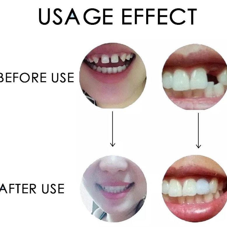 Produk Baru Temptooth Diy Temporary Tooth Repair Kit Denture Adhesive Teeth Lem Gigi Palsu Tambal Se