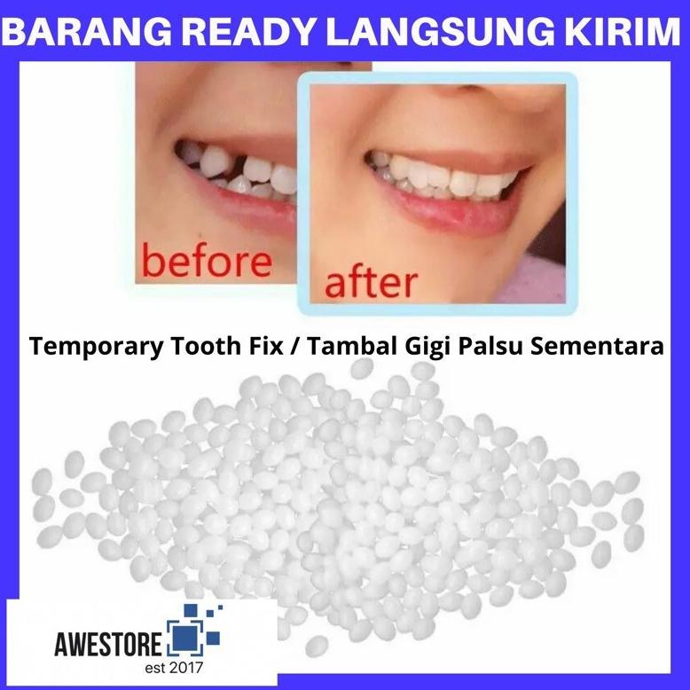 Baru Temptooth Diy Temporary Tooth Repair Kit Denture Adhesive Teeth Lem Gigi Palsu Tambal Sementara