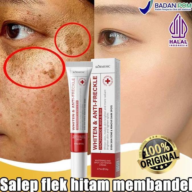 KORMESIC Whitening Freckle Cream BPOM Krim Penghilang Flek Hitam & Melasma