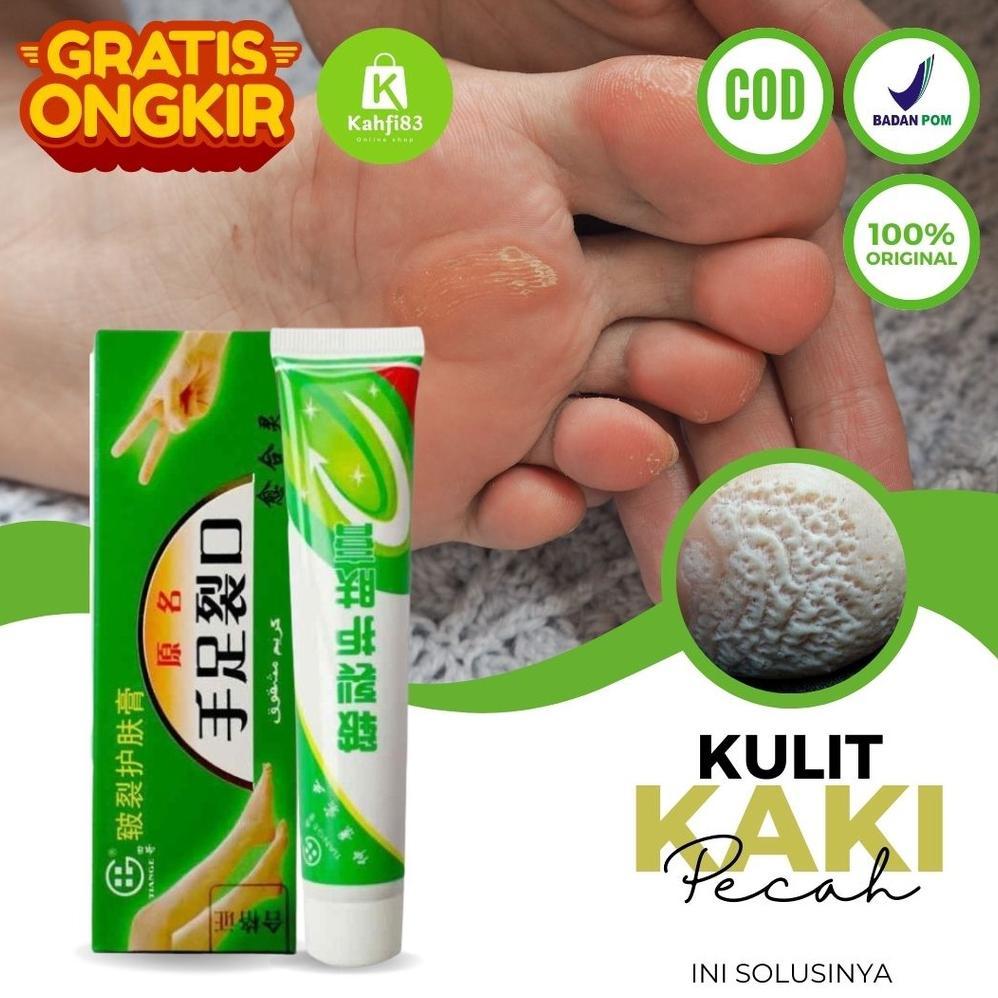 CantikQ- Obat Kaki Rayapan dan Bau - Obat Kaki Pecah Pecah dan Kering dan Kasar Penghilang Kapalan K