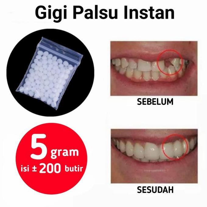 @@@@] Gigi Palsu Instan Buat Sendiri Penambal Ompong Temptooth Temporary