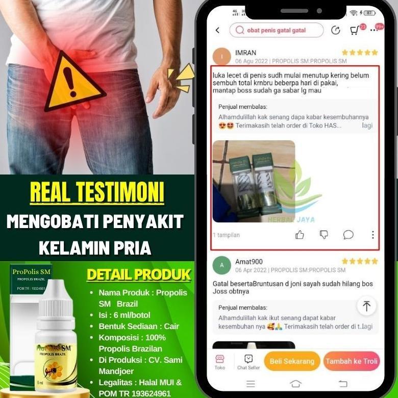 MS Obat Oles Gatal Batang Kemaluan Pria, Gatal di Kepala Penis, Gatel di Penis, Obat Gatal di Buah Z