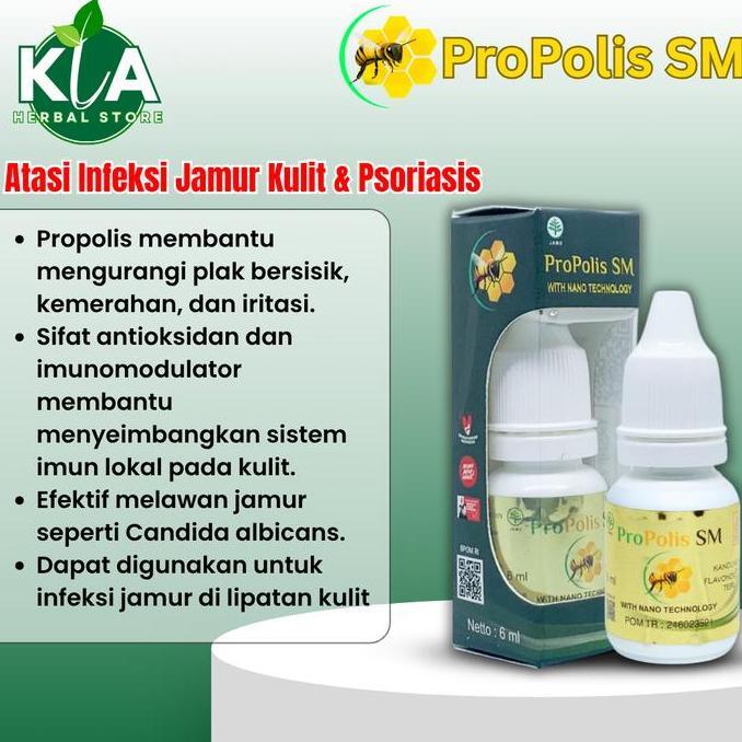 Obat Infeksi Jamur Psoriasis, Ketombe Kerak Kulit Kepala, Koreng di Kepala, Rambut Rontok, Psoriasis